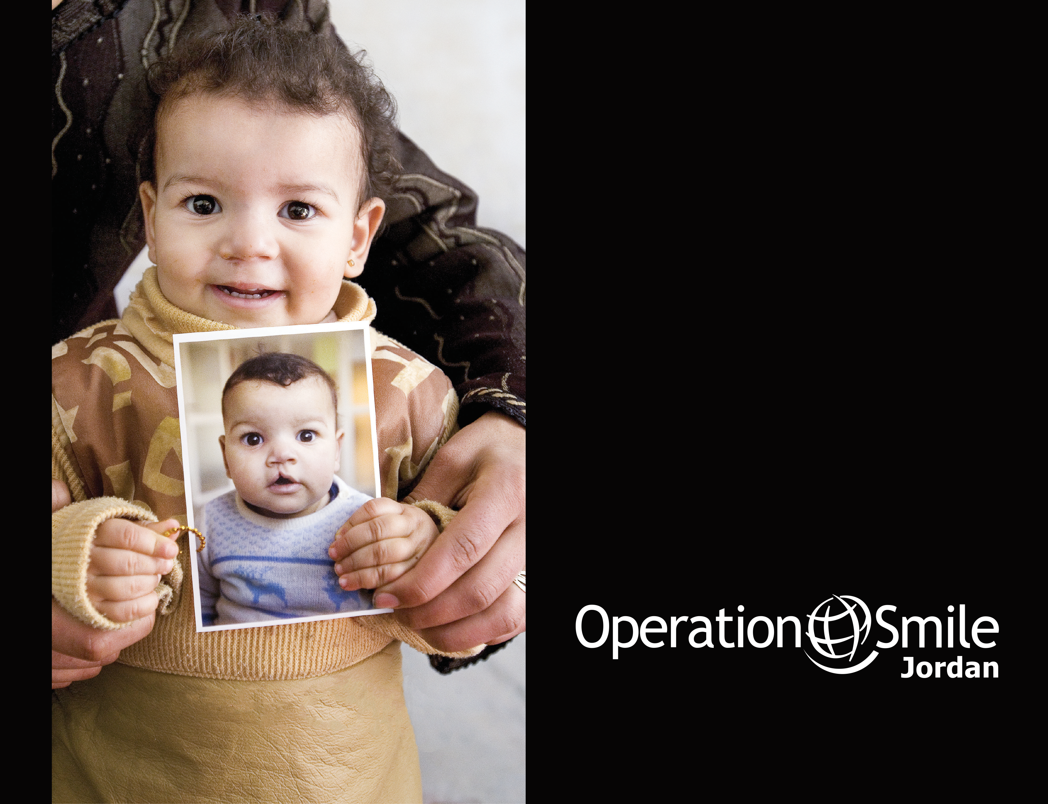 Operation Smile Jordan
